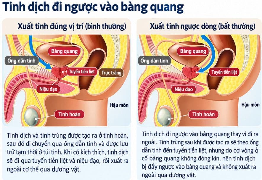 Phẫu thuật ung thư tuyến tiền liệt từ phía sau giúp 90% bệnh nhân phục hồi khả năng kiểm soát tiểu tiện trong một tuần