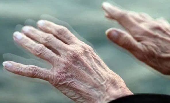 Tiếng ồn giao thông kéo dài có thể làm tăng nguy cơ mắc bệnh Parkinson, nghiên cứu trên hơn 3,1 triệu người chỉ ra điều gì?
